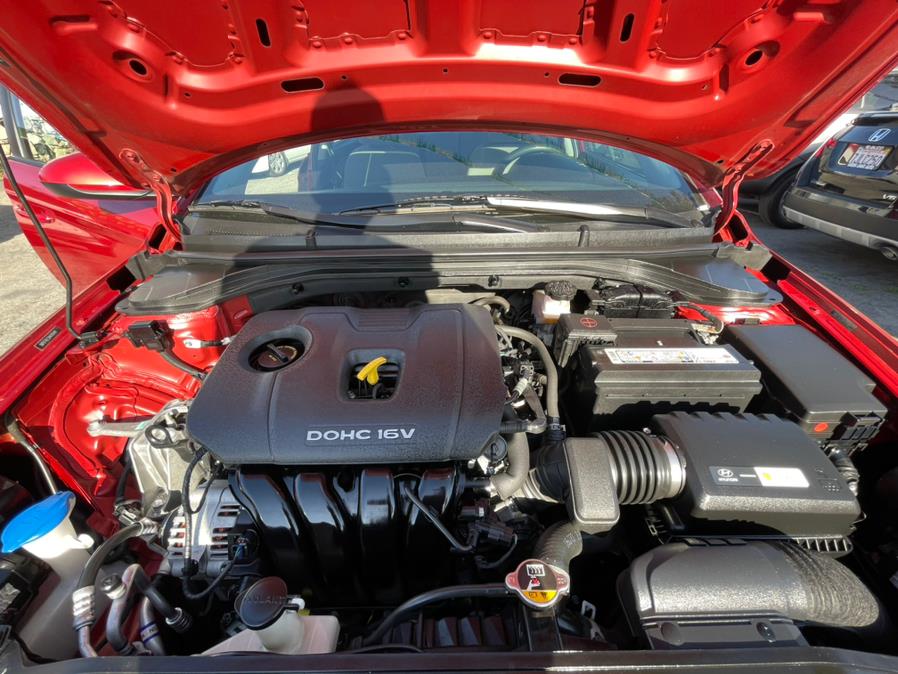 2017 Hyundai Elantra SE Sedan 4D, available for sale in Corona, California | Green Light Auto. Corona, California 2017 Hyundai Elantra SE Sedan 4D, available for sale in Corona, California | Green Light Auto. Corona, California