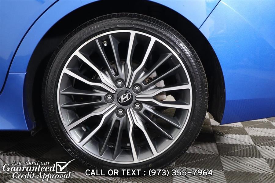 2017 Hyundai Elantra Sport, available for sale in Haskell, New Jersey | City Motor Group Inc.. Haskell, New Jersey 2017 Hyundai Elantra Sport, available for sale in Haskell, New Jersey | City Motor Group Inc.. Haskell, New Jersey