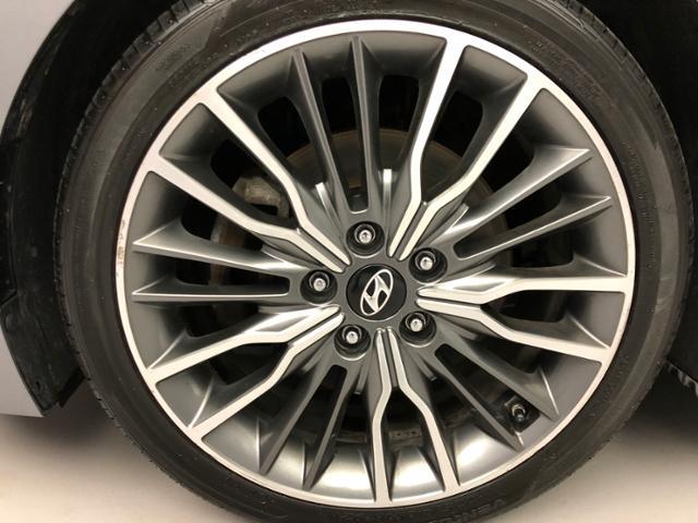 2017 Hyundai Elantra Sport 1.6T Auto, available for sale in Naugatuck, Connecticut | J&M Automotive Sls&Svc LLC. Naugatuck, Connecticut 2017 Hyundai Elantra Sport 1.6T Auto, available for sale in Naugatuck, Connecticut | J&M Automotive Sls&Svc LLC. Naugatuck, Connecticut