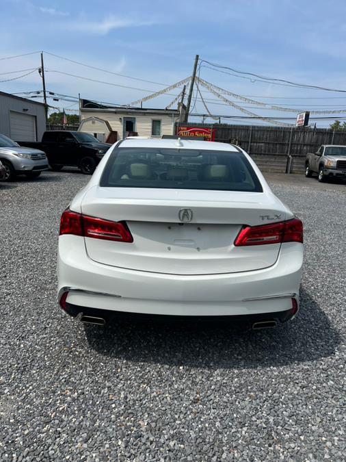 2019 Acura TLX Technology Package photo 3