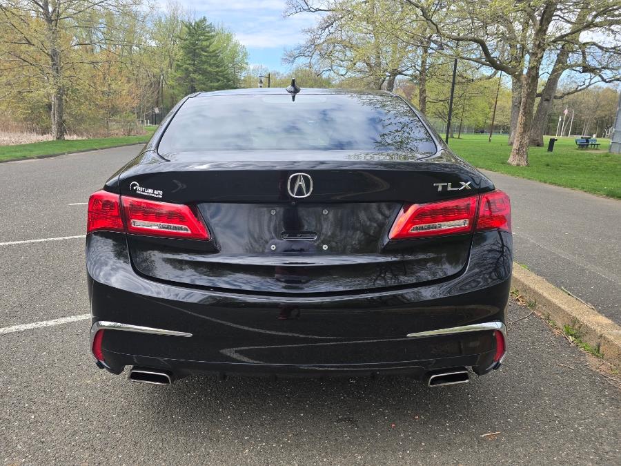 2018 Acura TLX 3.5L FWD, available for sale in Springfield, Massachusetts | Fast Lane Auto Sales & Service, Inc. . Springfield, Massachusetts 2018 Acura TLX 3.5L FWD, available for sale in Springfield, Massachusetts | Fast Lane Auto Sales & Service, Inc. . Springfield, Massachusetts