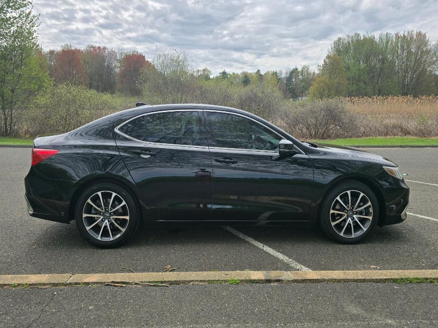 2018 Acura TLX 3.5L FWD, available for sale in Springfield, Massachusetts | Fast Lane Auto Sales & Service, Inc. . Springfield, Massachusetts 2018 Acura TLX 3.5L FWD, available for sale in Springfield, Massachusetts | Fast Lane Auto Sales & Service, Inc. . Springfield, Massachusetts