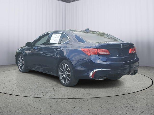 2018 Acura Tlx 3.5L FWD, available for sale in Fort Myers, Florida | Carlux Fort Myers. Fort Myers, Florida 2018 Acura Tlx 3.5L FWD, available for sale in Fort Myers, Florida | Carlux Fort Myers. Fort Myers, Florida