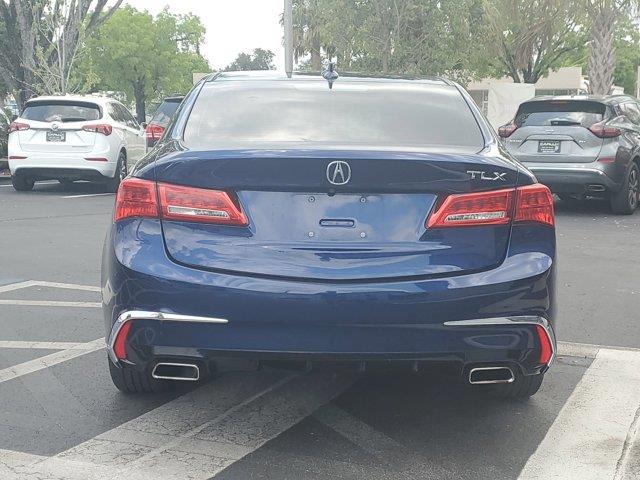 2018 Acura Tlx 3.5L FWD, available for sale in Fort Myers, Florida | Carlux Fort Myers. Fort Myers, Florida 2018 Acura Tlx 3.5L FWD, available for sale in Fort Myers, Florida | Carlux Fort Myers. Fort Myers, Florida