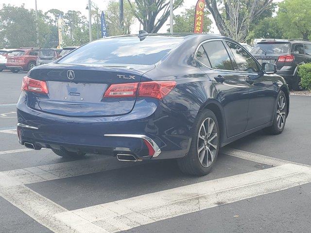 2018 Acura Tlx 3.5L FWD, available for sale in Fort Myers, Florida | Carlux Fort Myers. Fort Myers, Florida 2018 Acura Tlx 3.5L FWD, available for sale in Fort Myers, Florida | Carlux Fort Myers. Fort Myers, Florida